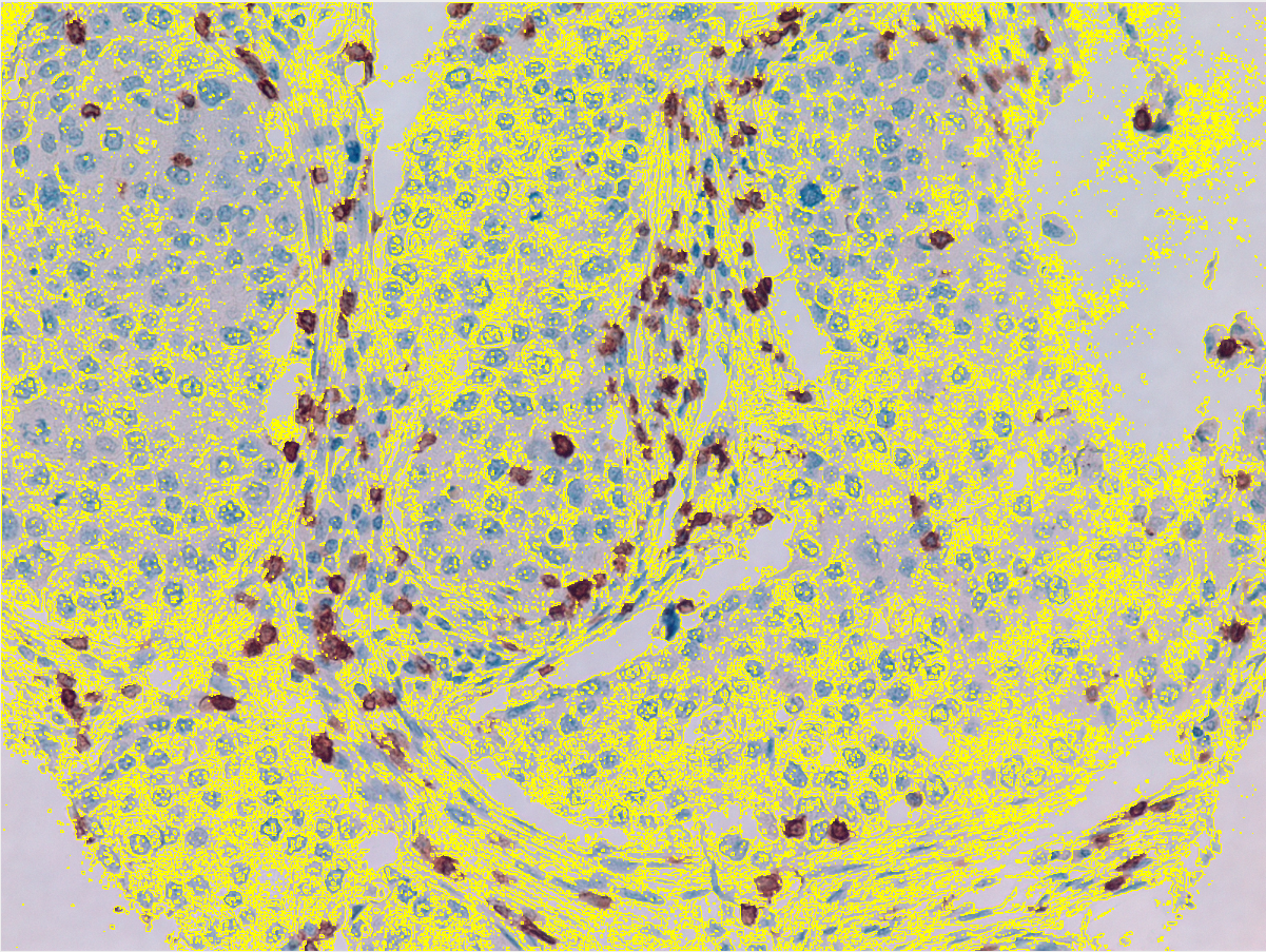 Stained tissue
