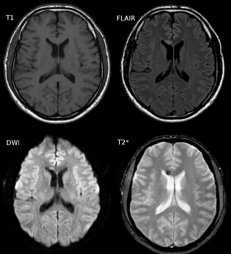 MRI exmaples